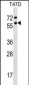 GTF2F1 Antibody (Center)